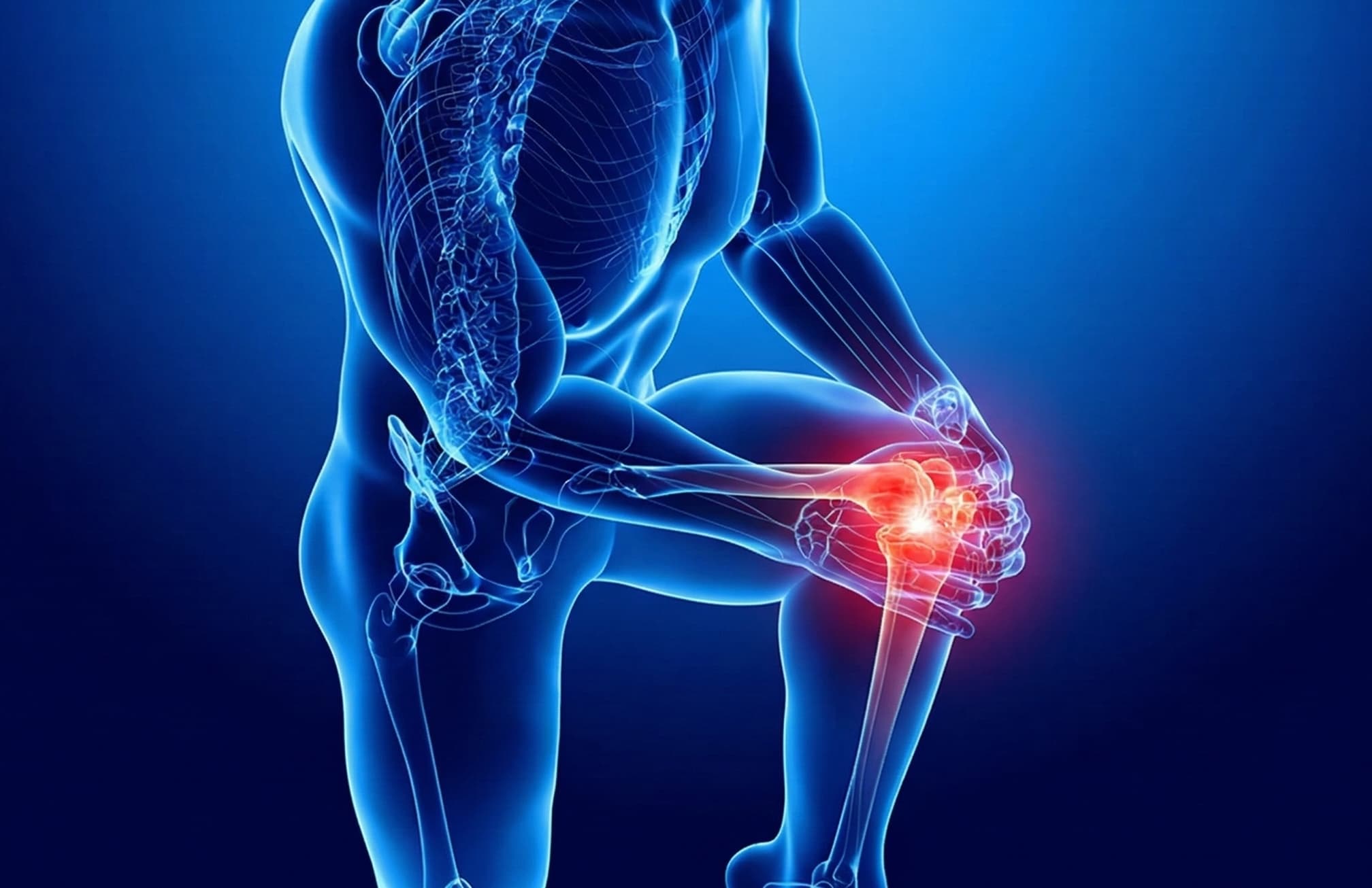 Interventional radiology suite for Genicular Artery Embolization procedures